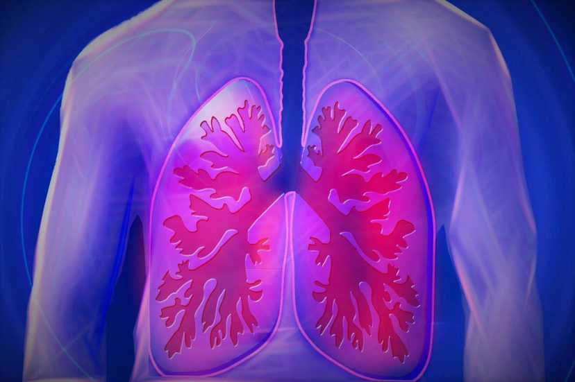 Definition Of Obstructive Pulmonary Disease