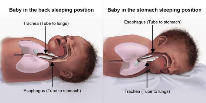 Infant lying on stomach and back. Image courtesy of the Safe to Sleep® campaign, for educational purposes only; Eunice Kennedy Shriver National Institute of Child Health and Human Development, http://www.nichd.nih.gov/sids; Safe to Sleep® is a registered trademark of the U.S. Department of Health and Human Services