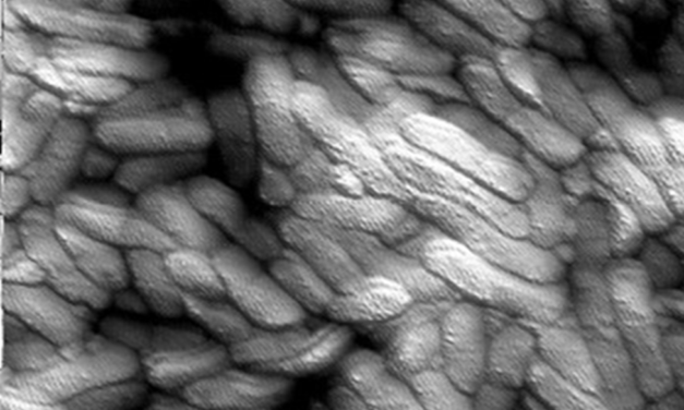 Bacterial Attachment to Food and Food Processing Surfaces Can Lead to Biofilm Formation